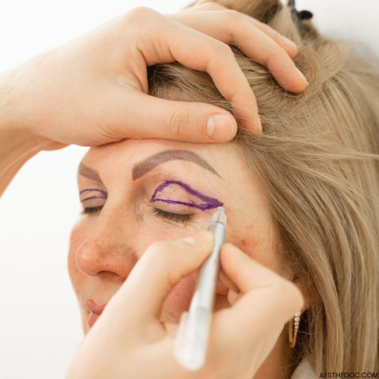 Eyelid Surgery Blepharoplasty In Pakistan