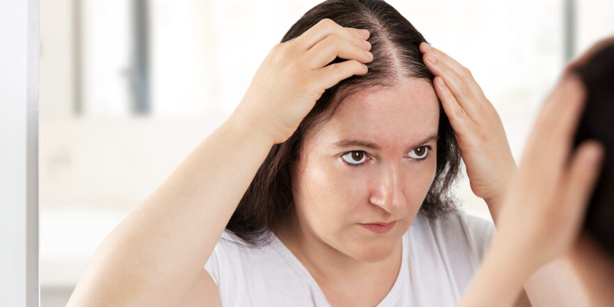 Hair Loss Treatments Recommended For Men & Women in Pakistan