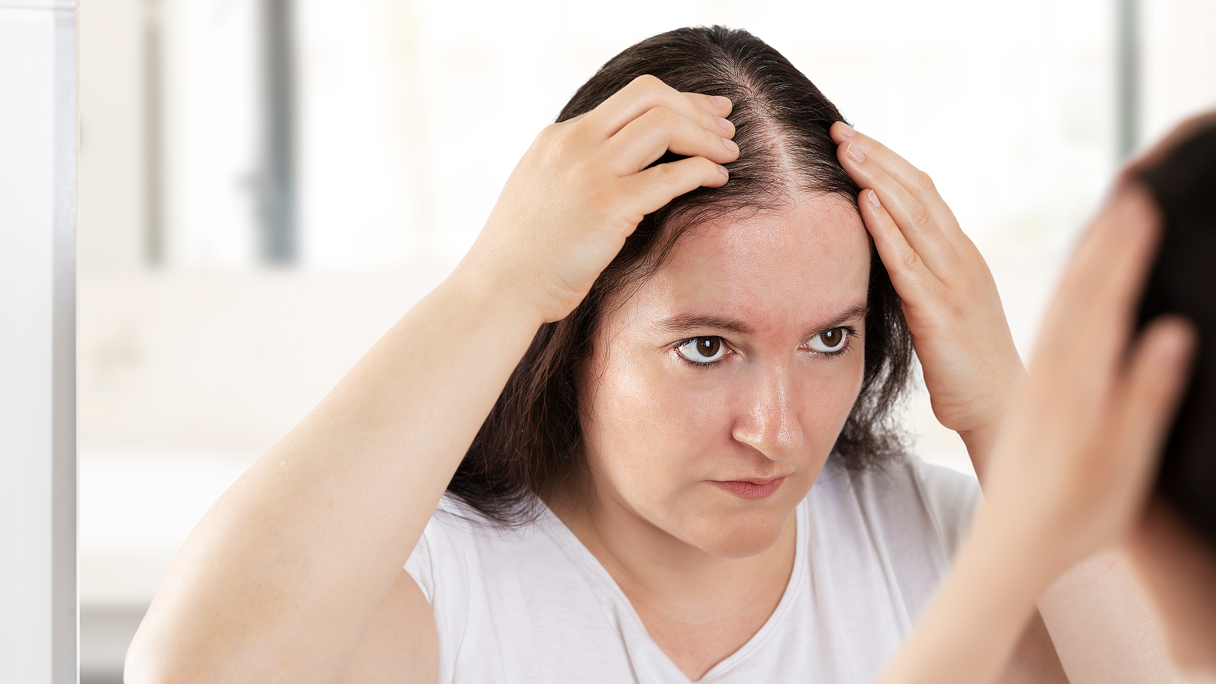 Hair Loss Treatments Recommended For Men & Women in Pakistan