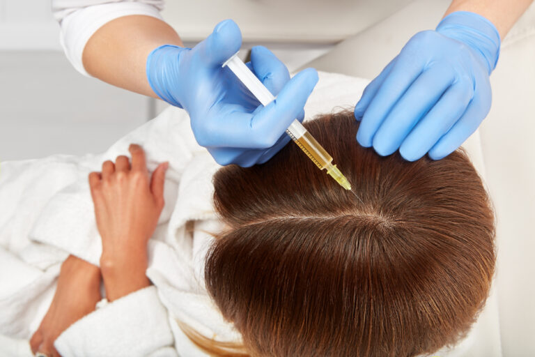 What is PRP Therapy? Hair Loss Treatment